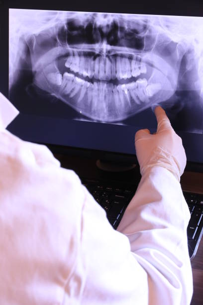 Best Emergency Root Canal Treatment in Amity, OR
